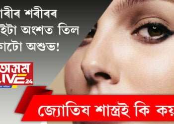 নাৰীৰ শৰীৰৰ এইকেইটা অংশত তিল থকাটো অশুভ! জ্যোতিষ শাস্ত্ৰই কোনকেইটা স্থানৰ কথা কৈছে?