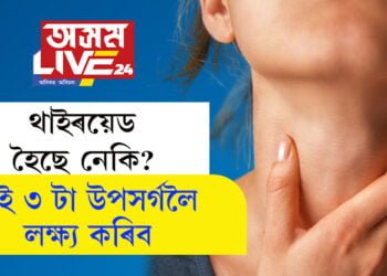 থাইৰয়েড হৈছে নেকি? ভৰিত দেখা দিয়া এই ৩ টা উপসৰ্গ চায়েই বুজিব…