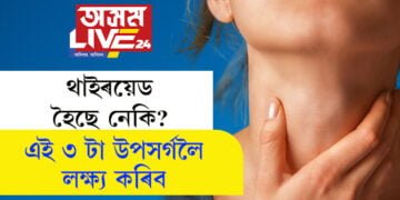 থাইৰয়েড হৈছে নেকি? ভৰিত দেখা দিয়া এই ৩ টা উপসৰ্গ চায়েই বুজিব…