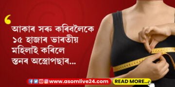 স্তনৰ আকাৰ সৰু কৰিবলৈকে অস্ত্ৰোপছাৰ! অস্ত্ৰোপছাৰেৰে ১৫ হাজাৰ ভাৰতীয় মহিলাই সৰু কৰিছে স্তনৰ আকাৰ, কিন্তু কিয় এই প্ৰবণতা বাঢ়িছে ভাৰতীয় নাৰীৰ মাজত?