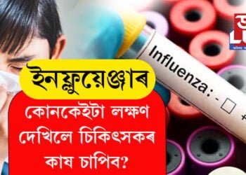 প্ৰাণঘাতী ইনফ্লুয়েঞ্জাৰ কোনকেইটা লক্ষণ দেখিলে চিকিৎসকৰ কাষ চাপিব? সবিশেষ…