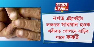 নখত এইকেইটা লক্ষণ দেখিলেই সাৱধান হওক! কৰ্কটৰ লক্ষণে দেখা দিয়ে নখত…
