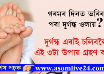 গৰমৰ দিনত ভৰিৰ পৰা দুৰ্গন্ধ ওলায়? দুৰ্গন্ধ এৰাই চলিবলৈ এই তিনিটা উপায় অৱলম্বন কৰিব পাৰে
