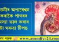 কিডনীত পাথৰ বৃহৎ সমস্যা! কিডনীৰ অপাৰেশ্বন নকৰাকৈ পাথৰৰ সমস্যা ভাল কৰাৰ ৫টা ঘৰুৱা টিপছ