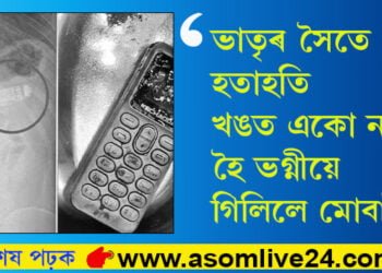 ভাতৃৰ সৈতে হতাহতি, খঙত একো নাই হৈ ভগ্নীয়ে গিলিলে মোবাইল! তাৰপিছত…