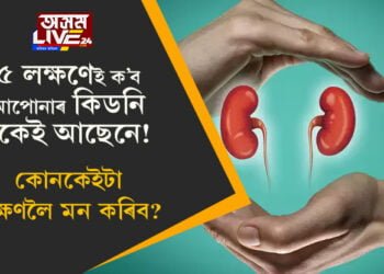৫ লক্ষণেই ক’ব আপোনাৰ কিডনি ঠিকেই আছেনে! কোনকেইটা লক্ষণলৈ মন কৰিব?