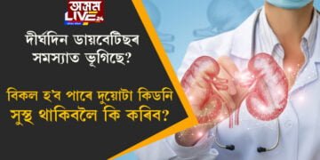 দীৰ্ঘদিন ডায়বেটিছৰ সমস্যাত ভূগিছে? বিকল হ’ব পাৰে দুয়োটা কিডনি, সুস্থ থাকিবলৈ কি কৰিব?