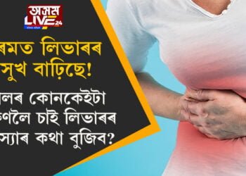 গৰমত লিভাৰৰ অসুখ বাঢ়িছে! ছালৰ কোনকেইটা লক্ষণলৈ চাই লিভাৰৰ সমস্যাৰ কথা বুজিব?
