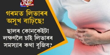 গৰমত লিভাৰৰ অসুখ বাঢ়িছে! ছালৰ কোনকেইটা লক্ষণলৈ চাই লিভাৰৰ সমস্যাৰ কথা বুজিব?