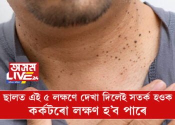 ৫টা লক্ষণঃ ছালত এই ৫ লক্ষণে দেখা দিলেই সতৰ্ক হওক, কৰ্কটৰো লক্ষণ হ’ব পাৰে