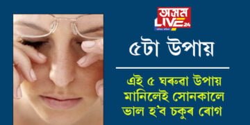 ৫টা উপায়ঃ এই ৫ ঘৰুৱা উপায় মানিলেই সোনকালে ভাল হ’ব চকুৰ ৰোগ