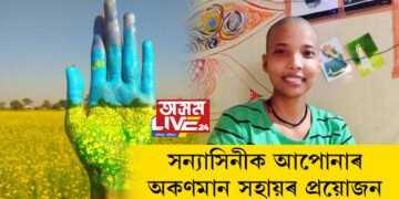 বেলিফুল ভালপোৱা সন্যাসিনীক আপোনাৰ অকণমান সহায়ৰ প্ৰয়োজন, সন্যাক চিকিৎসাৰ বাবে আপুনিও অলপমান সহায় আগবঢ়াওক