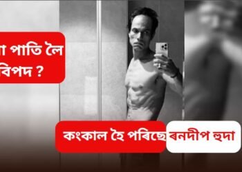বিয়া পাতি লৈ বিপদ ? কংকাল হৈ পৰিছে ৰনদীপ হুদা, ফটো দেখি কান্দি পেলালে মাতৃয়ে