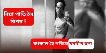 বিয়া পাতি লৈ বিপদ ? কংকাল হৈ পৰিছে ৰনদীপ হুদা, ফটো দেখি কান্দি পেলালে মাতৃয়ে