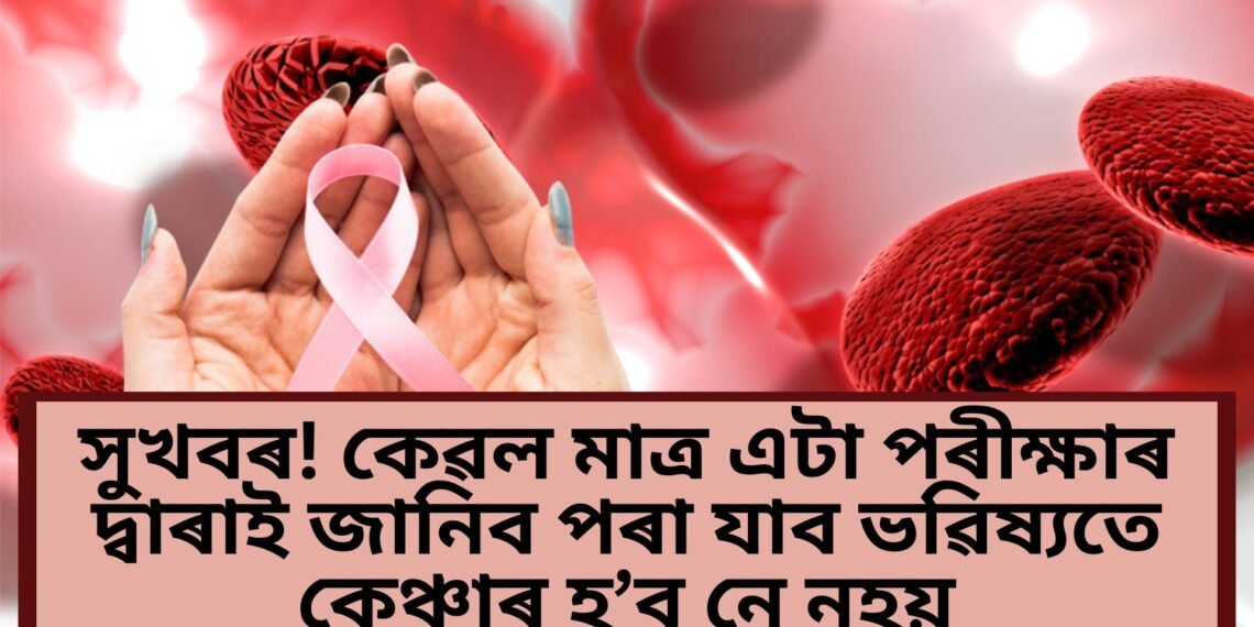 সুখবৰ! কেৱল মাত্ৰ এটা পৰীক্ষাৰ দ্বাৰাই জানিব পৰা যাব ভৱিষ্যতে কেঞ্চাৰ হ’ব নে নহয়, পূৰ্বেই কৰিব পাৰিব চিকিৎসা