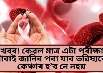 সুখবৰ! কেৱল মাত্ৰ এটা পৰীক্ষাৰ দ্বাৰাই জানিব পৰা যাব ভৱিষ্যতে কেঞ্চাৰ হ’ব নে নহয়, পূৰ্বেই কৰিব পাৰিব চিকিৎসা