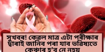 সুখবৰ! কেৱল মাত্ৰ এটা পৰীক্ষাৰ দ্বাৰাই জানিব পৰা যাব ভৱিষ্যতে কেঞ্চাৰ হ’ব নে নহয়, পূৰ্বেই কৰিব পাৰিব চিকিৎসা