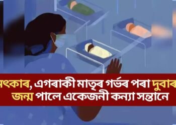 চমৎকাৰ, এগৰাকী মাতৃৰ গৰ্ভৰ পৰা দুবাৰকৈ জন্ম পালে একেজনী কন্যা সন্তানে