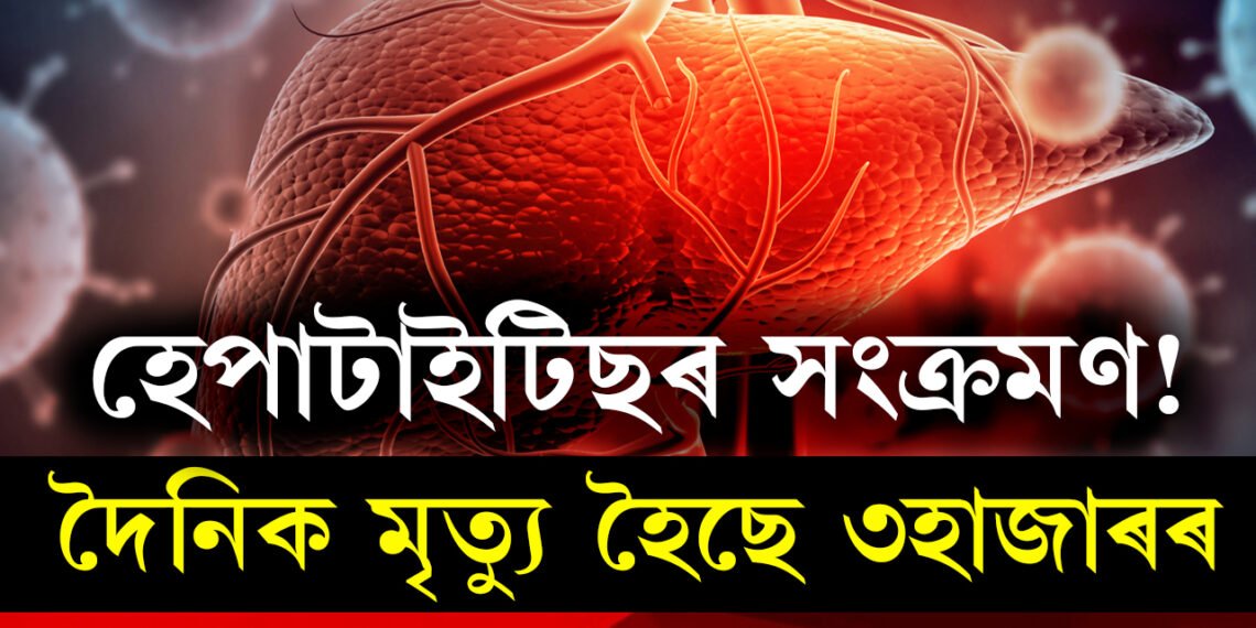 ভয়াৱহ হৈ উঠিছে হেপাটাইটিছৰ সংক্ৰমণ! দৈনিক মৃতকৰ হাৰ ৩হাজাৰ, কি সতৰ্কবাণী দিছে WHOয়ে?