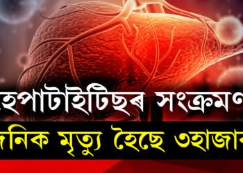 ভয়াৱহ হৈ উঠিছে হেপাটাইটিছৰ সংক্ৰমণ! দৈনিক মৃতকৰ হাৰ ৩হাজাৰ, কি সতৰ্কবাণী দিছে WHOয়ে?