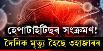 ভয়াৱহ হৈ উঠিছে হেপাটাইটিছৰ সংক্ৰমণ! দৈনিক মৃতকৰ হাৰ ৩হাজাৰ, কি সতৰ্কবাণী দিছে WHOয়ে?