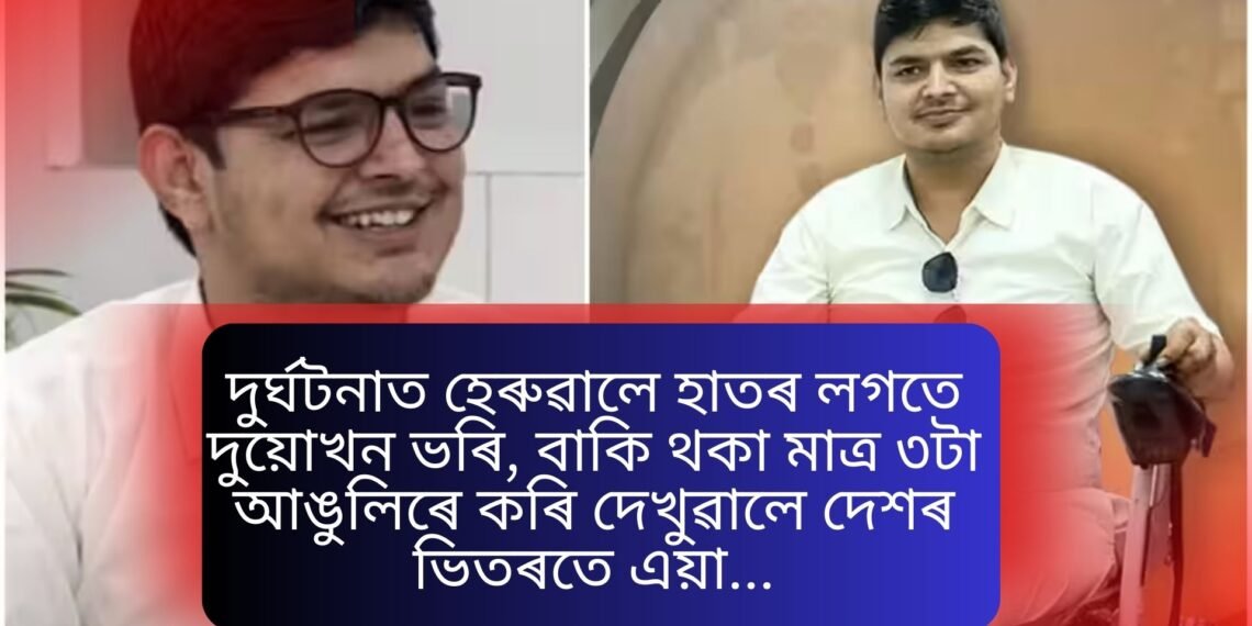 দুৰ্ঘটনাত হেৰুৱালে হাতৰ লগতে দুয়োখন ভৰি, বাকি থকা মাত্ৰ ৩টা আঙুলিৰে কৰি দেখুৱালে দেশৰ ভিতৰতে এয়া