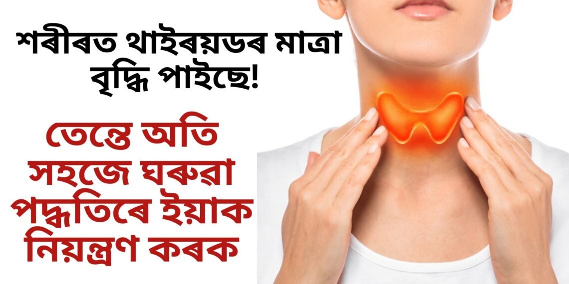 শৰীৰত থাইৰয়ডৰ মাত্ৰা বৃদ্ধি পাইছে, তেন্তে অতি সহজে ঘৰুৱা পদ্ধতিৰে ইয়াক নিয়ন্ত্ৰণ কৰক