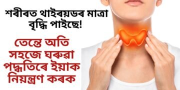 শৰীৰত থাইৰয়ডৰ মাত্ৰা বৃদ্ধি পাইছে, তেন্তে অতি সহজে ঘৰুৱা পদ্ধতিৰে ইয়াক নিয়ন্ত্ৰণ কৰক