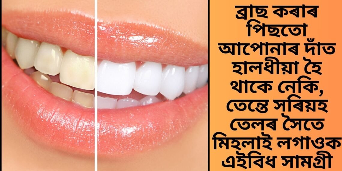 ব্ৰাছ কৰাৰ পিছতো আপোনাৰ দাঁত হালধীয়া হৈ থাকে নেকি, তেন্তে সৰিয়হৰ তেলৰ সৈতে মিহলাই লগাওক এইবিধ সামগ্ৰী
