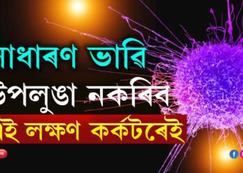 সাধাৰণ ভাৱি উপলুঙা নকৰিব এই ৫লক্ষণ, এই লক্ষণ কৰ্কটৰেই লক্ষণ
