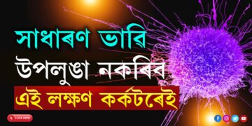 সাধাৰণ ভাৱি উপলুঙা নকৰিব এই ৫লক্ষণ, এই লক্ষণ কৰ্কটৰেই লক্ষণ