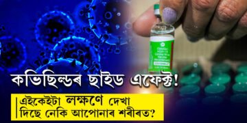 কভিছিল্ডৰ ছাইড এফেক্ট! এইকেইটা লক্ষণ দেখা দিছে নেকি আপোনাৰ শৰীৰত? টিটিএছ ৰোগ কি? জানক সবিশেষ