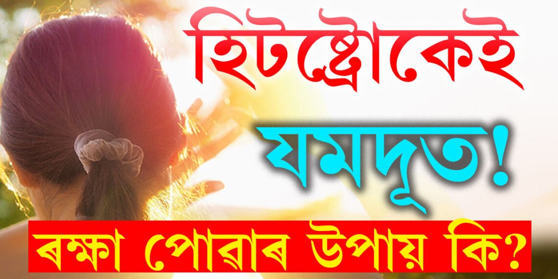 হিটষ্ট্ৰোকৰ লক্ষণ আৰু প্ৰতিৰোধৰ উপায় কি? কেনেকৈ ৰক্ষা পাব হিটষ্ট্ৰোকৰ পৰা?