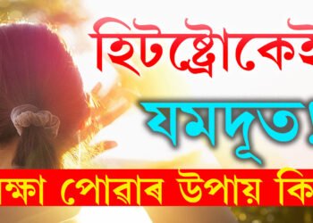 হিটষ্ট্ৰোকৰ লক্ষণ আৰু প্ৰতিৰোধৰ উপায় কি? কেনেকৈ ৰক্ষা পাব হিটষ্ট্ৰোকৰ পৰা?