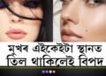 মুখৰ এই অংশত তিল থকা মুঠেও শুভ নহয়! চৰম দুঃখত পৰে এইকেইটা অংশত তিল থকা জাতক