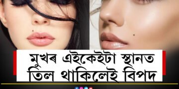 মুখৰ এই অংশত তিল থকা মুঠেও শুভ নহয়! চৰম দুঃখত পৰে এইকেইটা অংশত তিল থকা জাতক