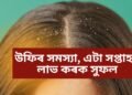 উফিৰ সমস্যা, বহু কৰিয়ো আঁতৰ হোৱা নাই, ব্যৱহাৰ কৰক এই সামগ্ৰী, এটা সপ্তাহতে লাভ কৰক সুফল