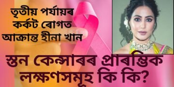 তৃতীয় পৰ্যায়ৰ কৰ্কট ৰোগত আক্ৰান্ত হীনা খান, আপুনিও থাকক সাৱধানে, স্তন কেন্সাৰৰ প্ৰাৰম্ভিক লক্ষণসমূহ কি কি?