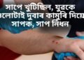 এক অদ্ভুত কাহিনী- সাপে খুটিছিল, যুৱকে ওলোটাই দুবাৰ কামুৰি দিয়ে সাপক, সাপ নিধন