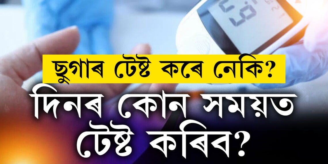 খাদ্য গ্ৰহণৰ পূৰ্বে আৰু পাছত ছুগাৰ টেষ্ট কৰে? ভুল সময়ত পৰীক্ষা কৰিলেই কিন্তু বিপদ আপোনাৰ