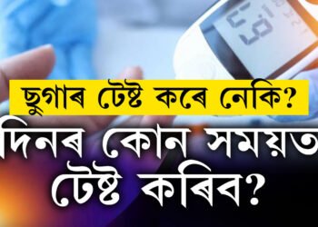 খাদ্য গ্ৰহণৰ পূৰ্বে আৰু পাছত ছুগাৰ টেষ্ট কৰে? ভুল সময়ত পৰীক্ষা কৰিলেই কিন্তু বিপদ আপোনাৰ