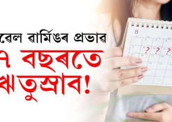 প্ৰৱল গৰমে বিঘ্নিত কৰিছে হৰমনৰ ভাৰসাম্য, কি কি পৰিবৰ্তন হ’ব মানৱ দেহৰ? গৱেষণাত প্ৰকাশ পাইছে তথ্য