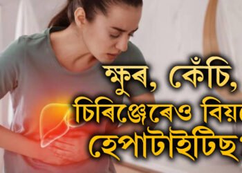 ব্যৱহৃত চিৰিঞ্জ, চেলুনৰ ক্ষুৰ-কেঁচিৰ পৰাও বিয়পে হেপাটাইটিছ? কেনেকৈ সাৱধান হ’ব?