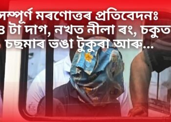 সম্পূৰ্ণ মৰণোত্তৰ প্ৰতিবেদনঃ ১৪ টা দাগ, নখত নীলা ৰং, চকুত চছমাৰ ভঙা টুকুৰা আৰু…