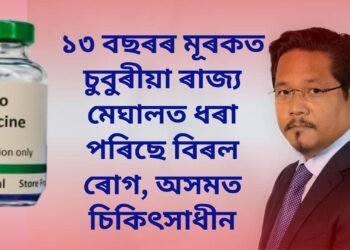 ১৩ বছৰৰ মূৰকত চুবুৰীয়া ৰাজ্য মেঘালত ধৰা পৰিছে বিৰল ৰোগ, অসমত চিকিৎসাধীন