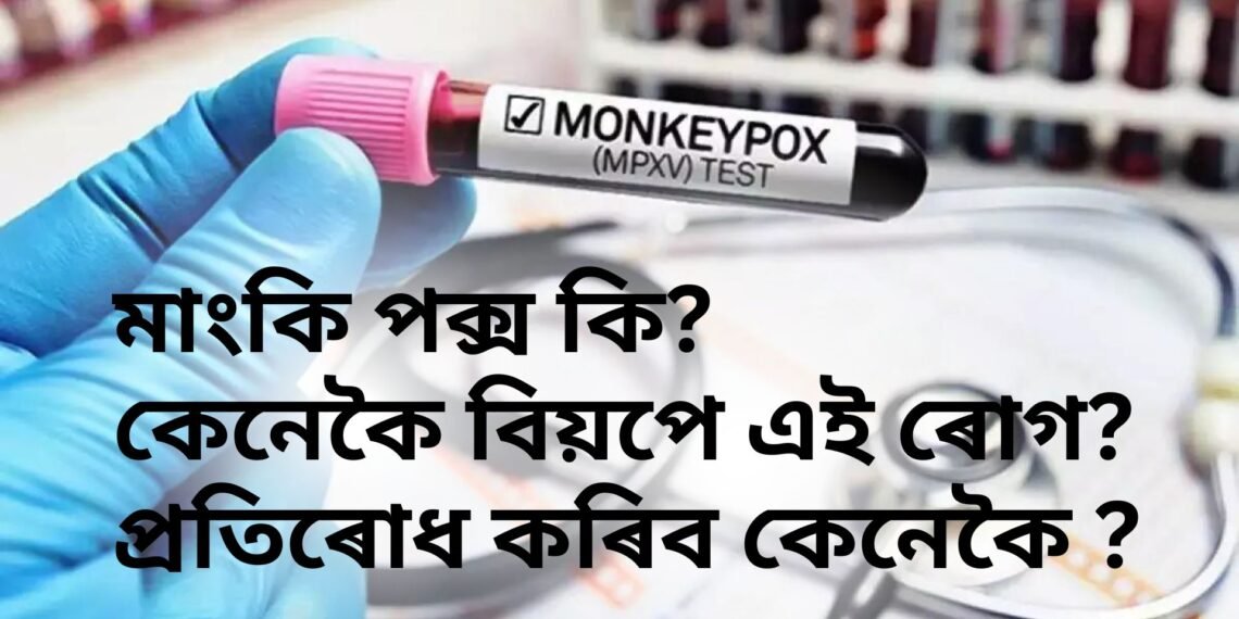 দ্ৰুত গতিত বিয়পিলৈ ধৰা মাংকি পক্স কি, কেনেকৈ বিয়পে এই ৰোগ, প্ৰতিৰোধ কৰিব কেনেকৈ !