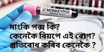 দ্ৰুত গতিত বিয়পিলৈ ধৰা মাংকি পক্স কি, কেনেকৈ বিয়পে এই ৰোগ, প্ৰতিৰোধ কৰিব কেনেকৈ !
