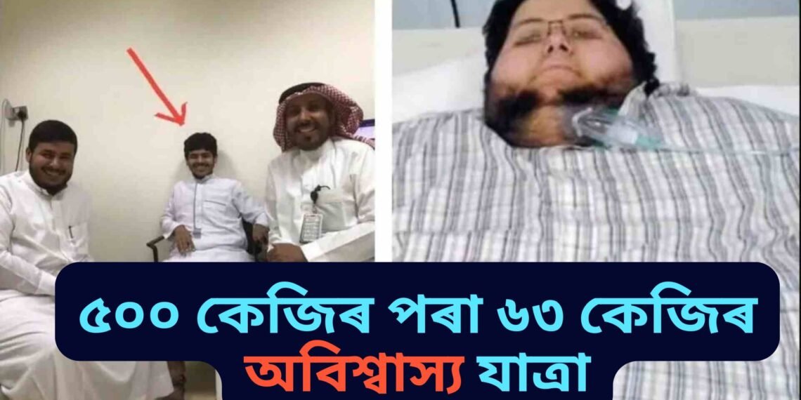 অবিশ্বাস্য যেন লাগিলেও সঁচা, ৫০০ কেজি হ্ৰাস কৰি চৰ্চাৰ কেন্দ্ৰবিন্দু বিশ্বৰ সবাতোকৈ শকত ব্যক্তিৰ