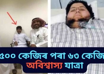 অবিশ্বাস্য যেন লাগিলেও সঁচা, ৫০০ কেজি হ্ৰাস কৰি চৰ্চাৰ কেন্দ্ৰবিন্দু বিশ্বৰ সবাতোকৈ শকত ব্যক্তিৰ