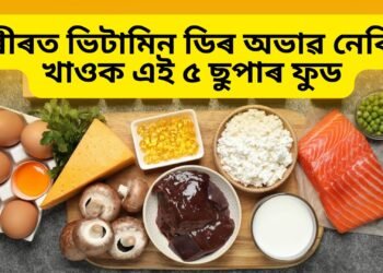 শৰীৰত ভিটামিন ডিৰ অভাৱ নেকি ! খাওক এই ৫ ছুপাৰ ফুড দূৰ হ’ব সমস্যা